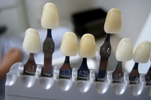 セラミックデンタル